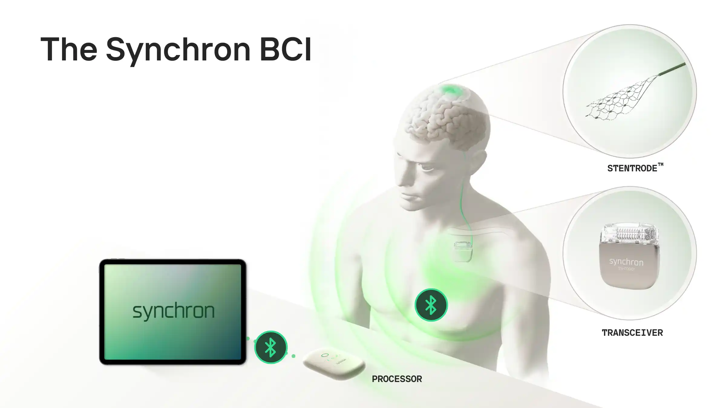 Apple implantes cerebrales