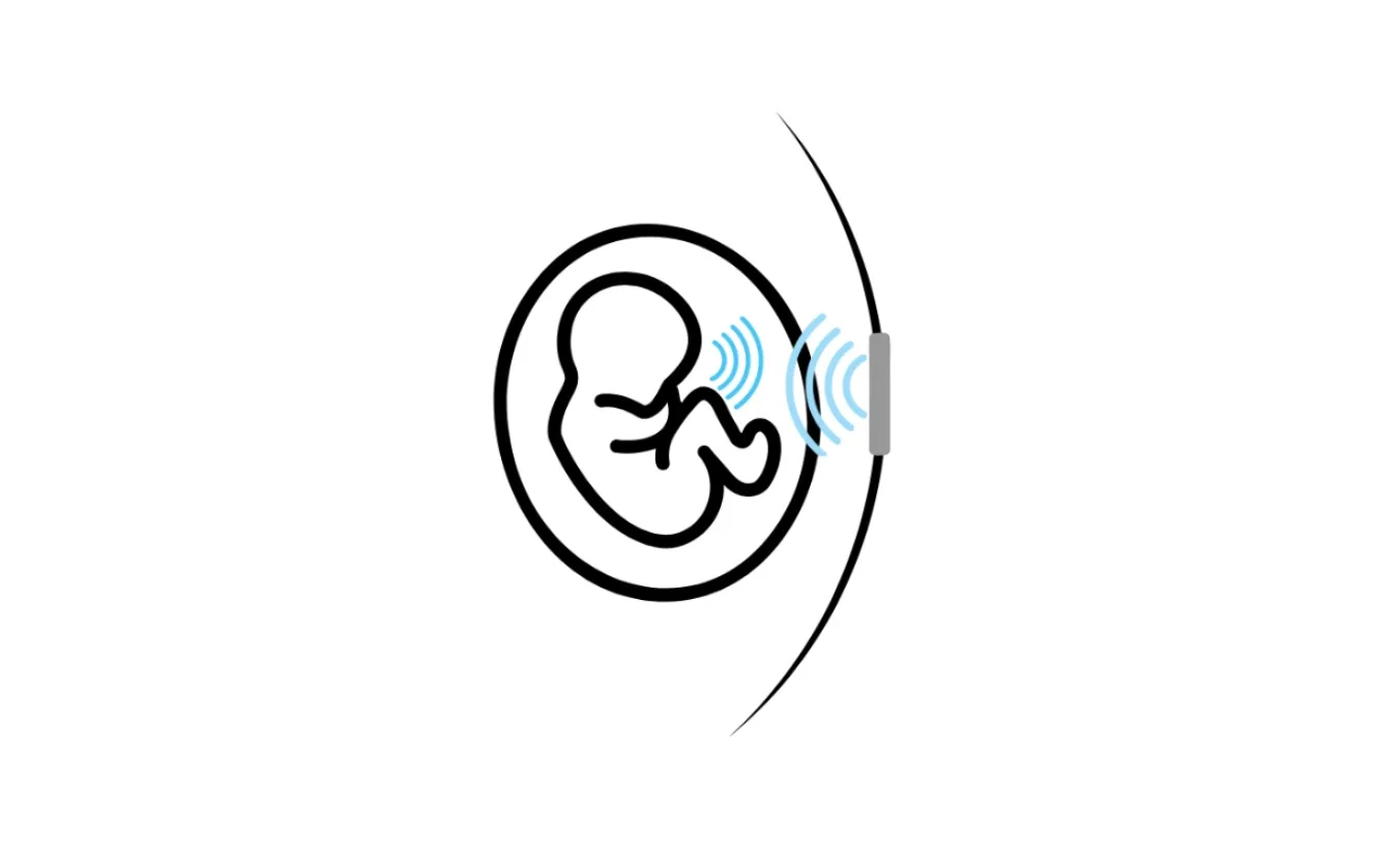 aplicación ritmo cardíaco fetal