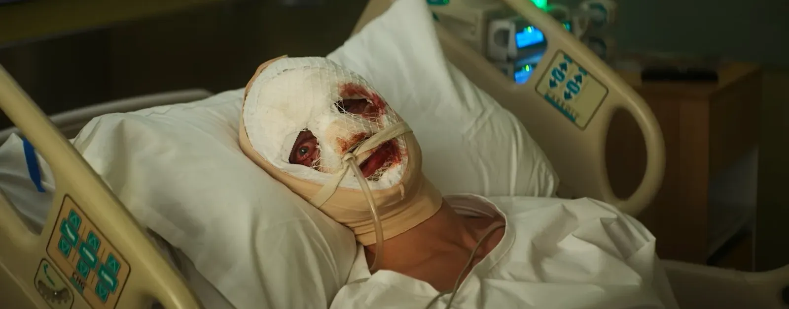 Matt Hagen con la cara vendada y lastimada en una camilla de hospital en una escena del tráiler de Clayface, la película de DC Studios